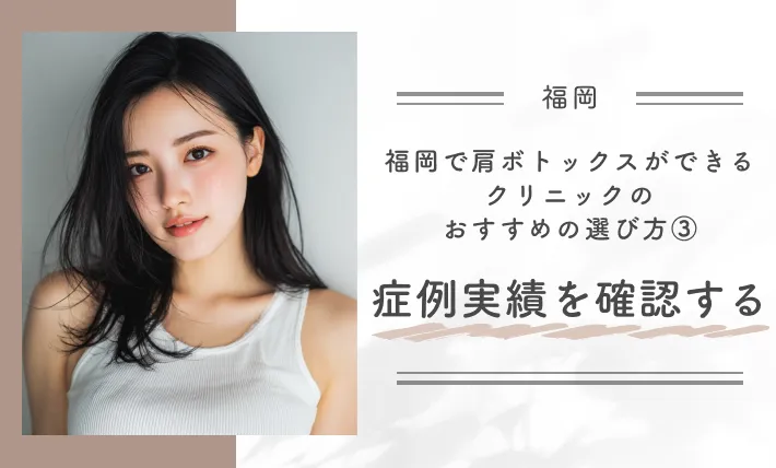 福岡で肩ボトックスができるクリニックのおすすめの選び方③症例実績を確認する