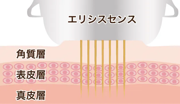エリシスセンス 仕組み