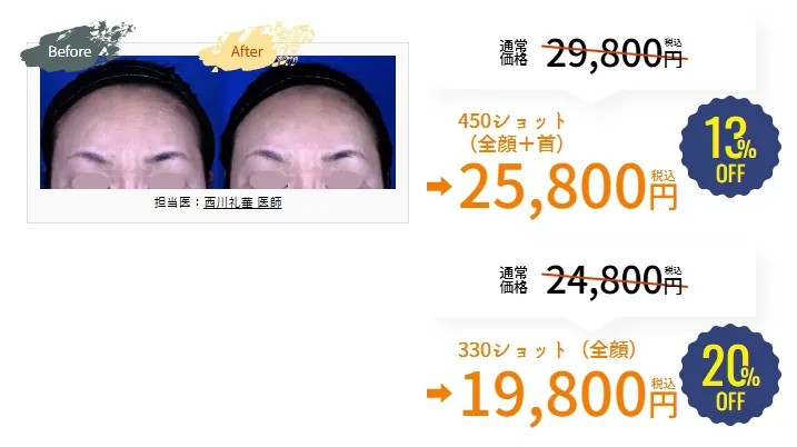 神戸で医療ハイフが安いおすすめ人気クリニック 湘南美容クリニックのLP画像 20%OFF