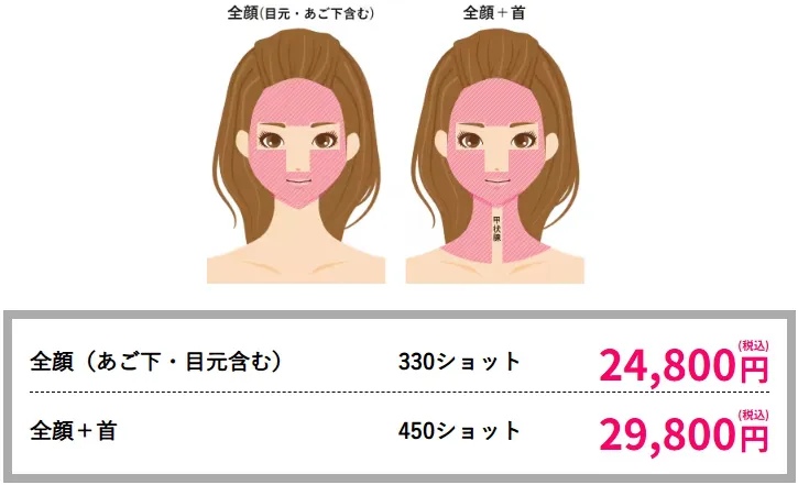 神戸で医療ハイフが安いおすすめ人気クリニック 湘南美容クリニックのLP画像 料金案内