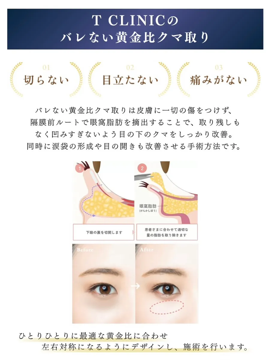 口コミで話題のTクリニックのクマ取りPR
