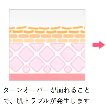 京都でケミカルピーリングが安いおすすめのクリニック 湘南美容クリニックの施術方法①