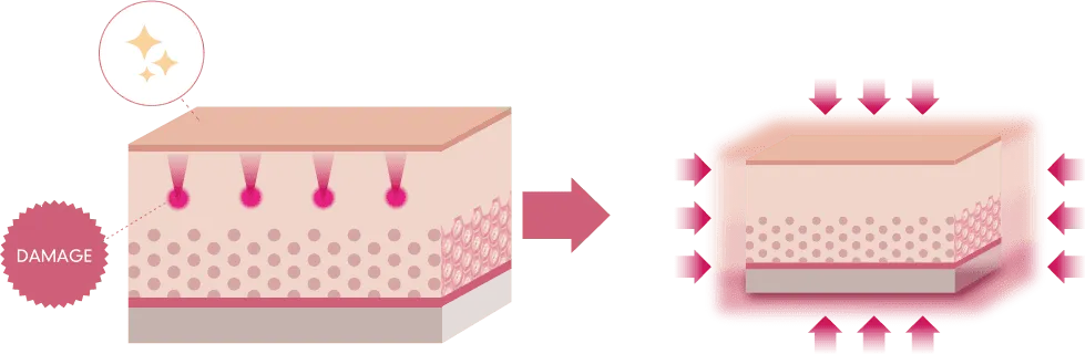 京都で医療ハイフの安いおすすめ人気クリニック 湘南美容クリニックのLP画像 施術詳細