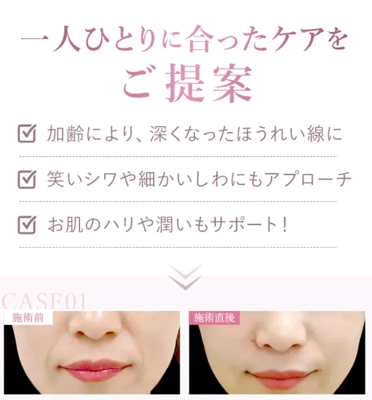 京都でヒアルロン酸注射ができるおすすめのクリニックTCBの提案について