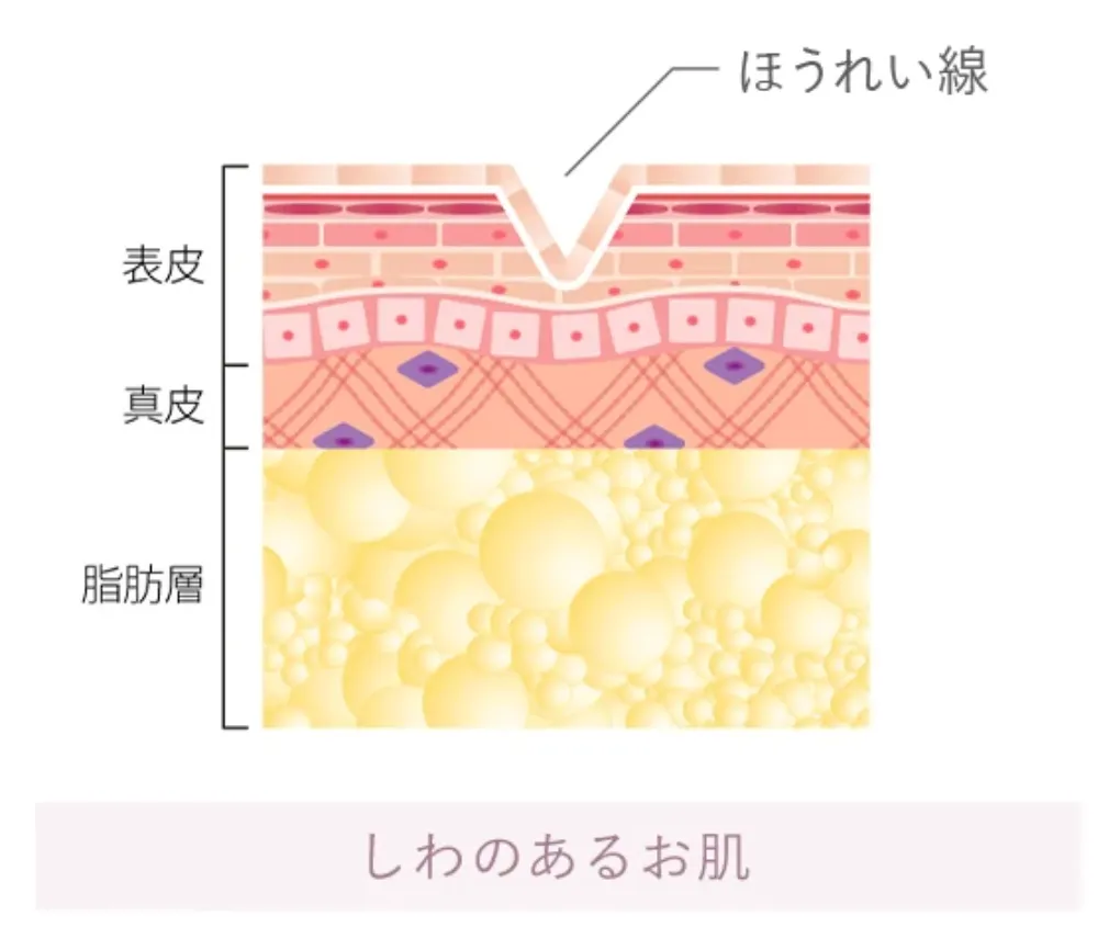 京都でヒアルロン酸注射ができるおすすめのクリニックTCBの施術の流れ①