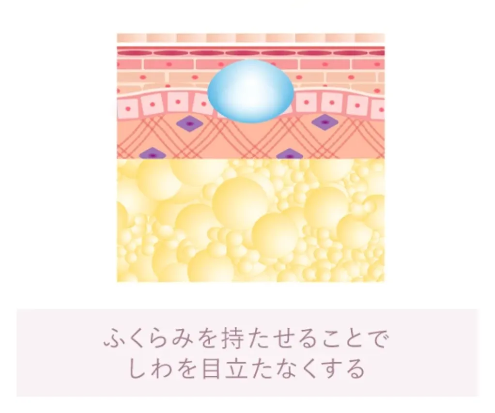 京都でヒアルロン酸注射ができるおすすめのクリニックTCBの施術の流れ③