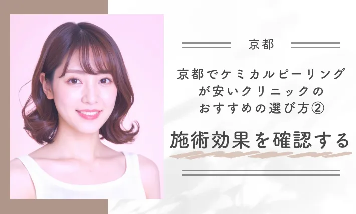 京都でケミカルピーリングが安いクリニックのおすすめの選び方②施術効果を確認する