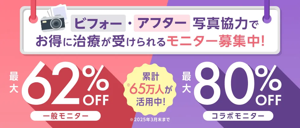 オンダリフトが安いおすすめクリニック 湘南美容クリニックのモニター割引