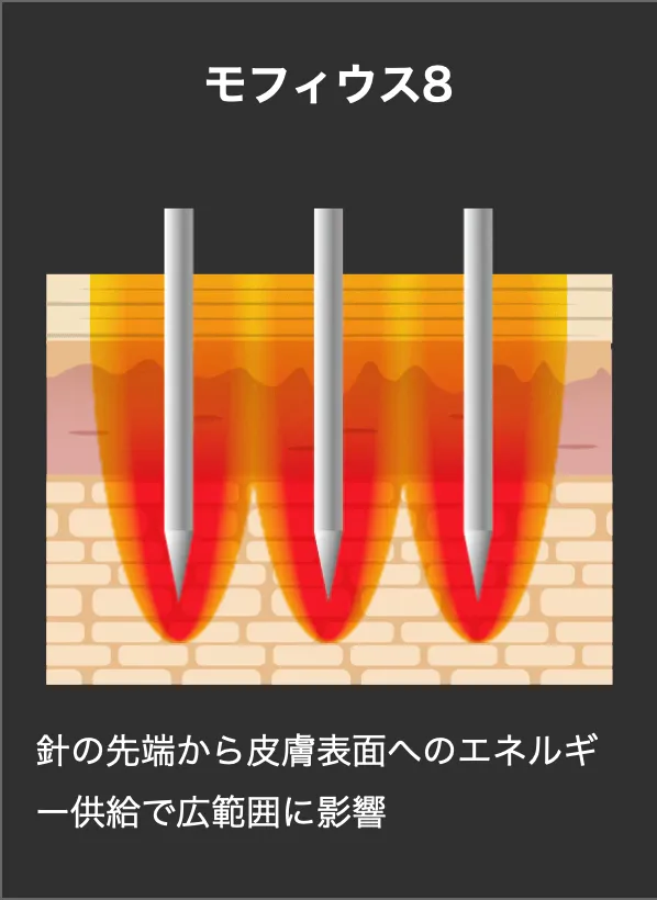 モフィウス8の仕組み
