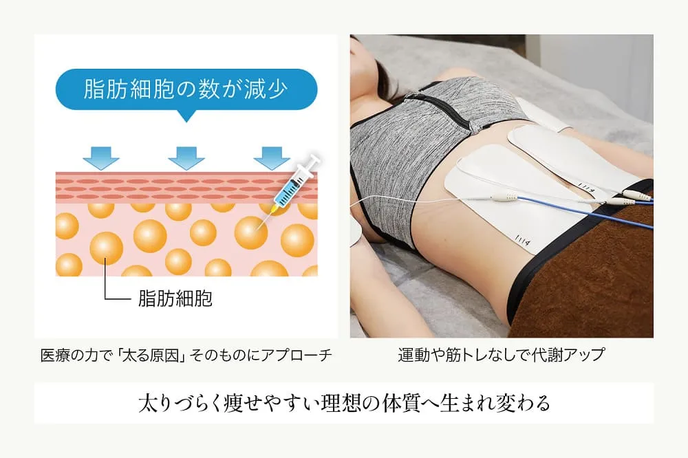 名古屋で脂肪冷却が安いおすすめクリニックであるディオクリニックの施術広告