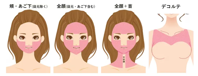 名古屋で医療ハイフの安いおすすめクリニックの施術範囲