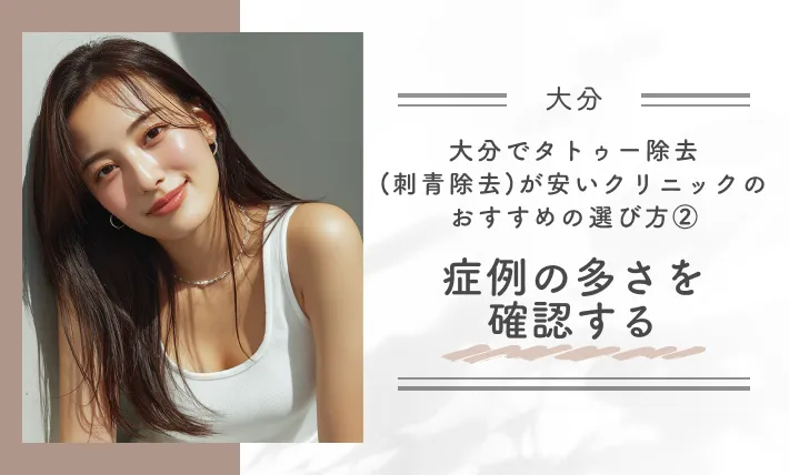 大分でタトゥー除去(刺青除去)が安いクリニックのおすすめの選び方②症例の多さを確認する
