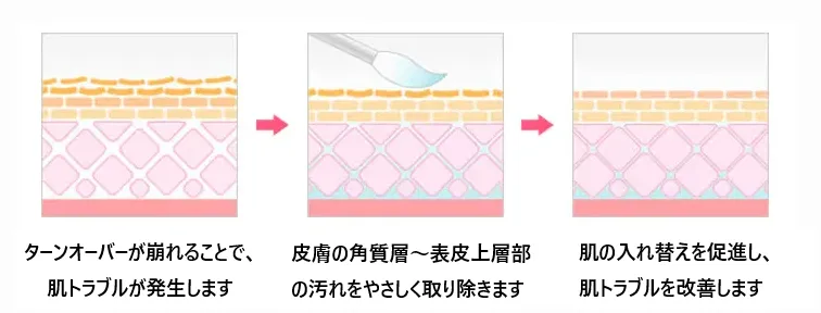 沖縄でケミカルピーリングが安いおすすめのクリニック 湘南美容クリニックの施術方法