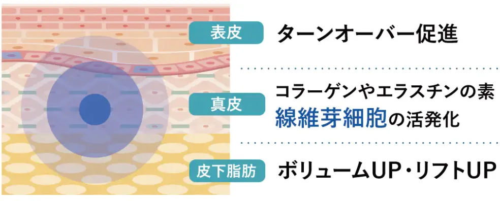 湘南美容クリニックのプロファイロはそれぞれの肌を若返らせて肌を再構築できる