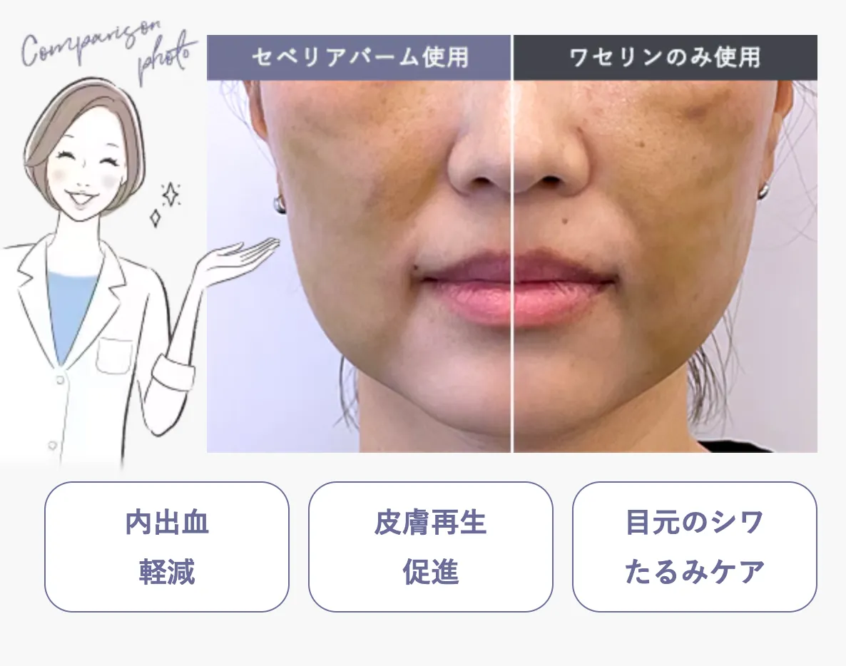 湘南美容クリニックのセベリアバームについて