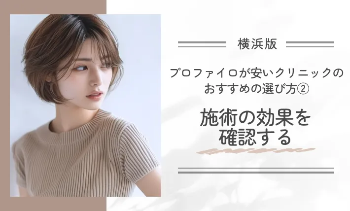 横浜でプロファイロが安いクリニックのおすすめの選び方②施術の効果を確認する