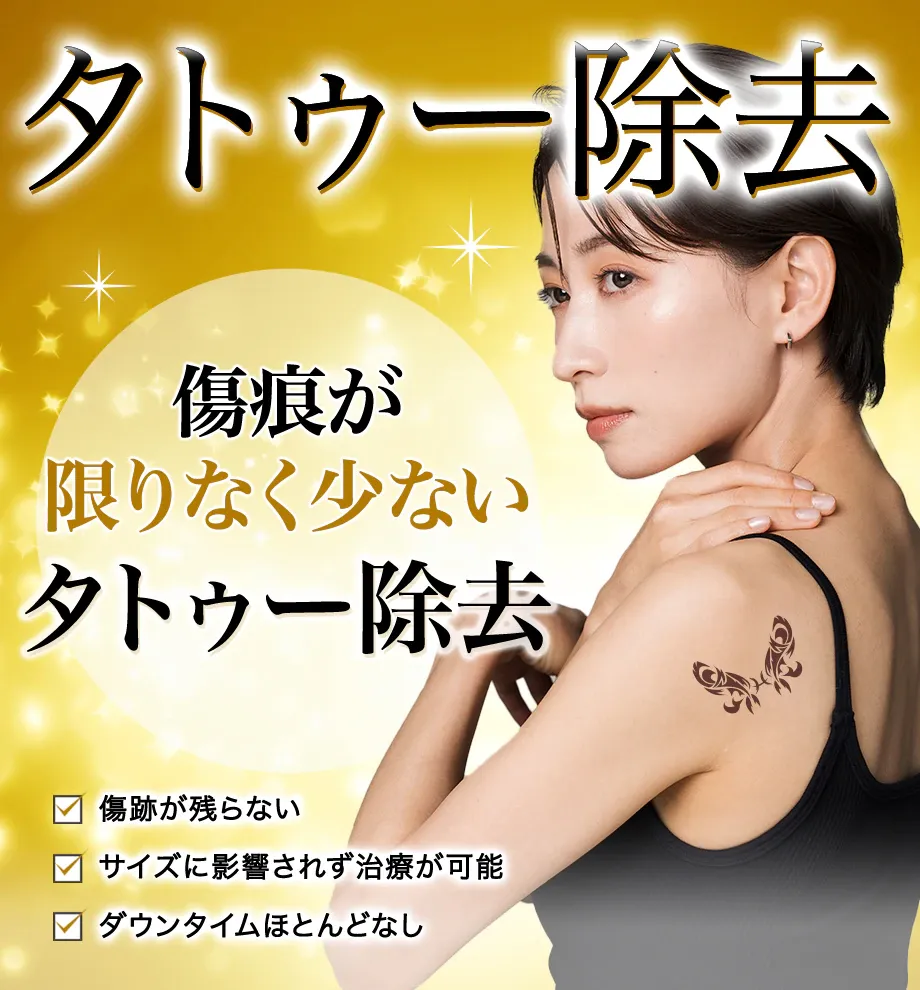 埼玉でおすすめの安いタトゥー除去(刺青除去)SBC