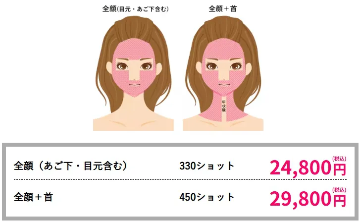 札幌で医療ハイフの安いおすすめの人気クリニック 湘南美容クリニックのLP画像 料金案内