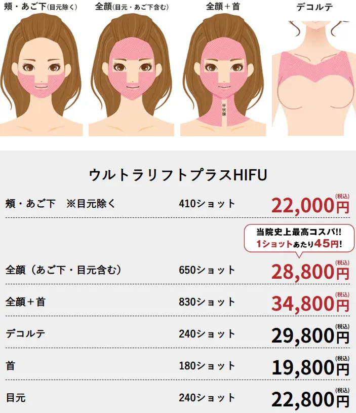 札幌で医療ハイフの安いおすすめの人気クリニック 湘南美容クリニックのLP画像 料金