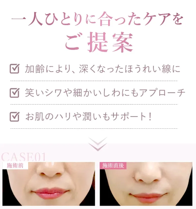 札幌でヒアルロン酸注射ができるおすすめのクリニック TCBの提案