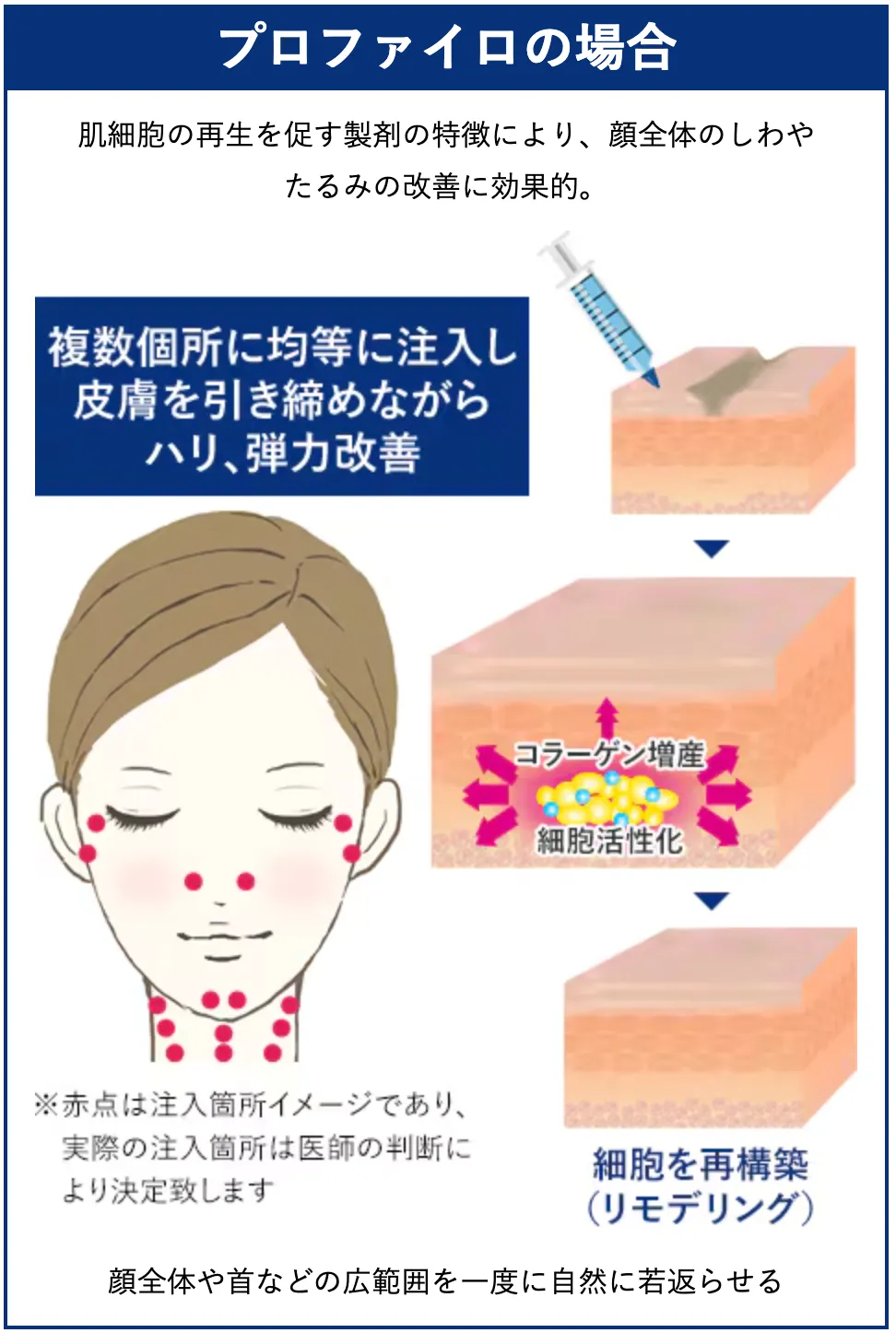 湘南美容クリニックのプロファイロの説明