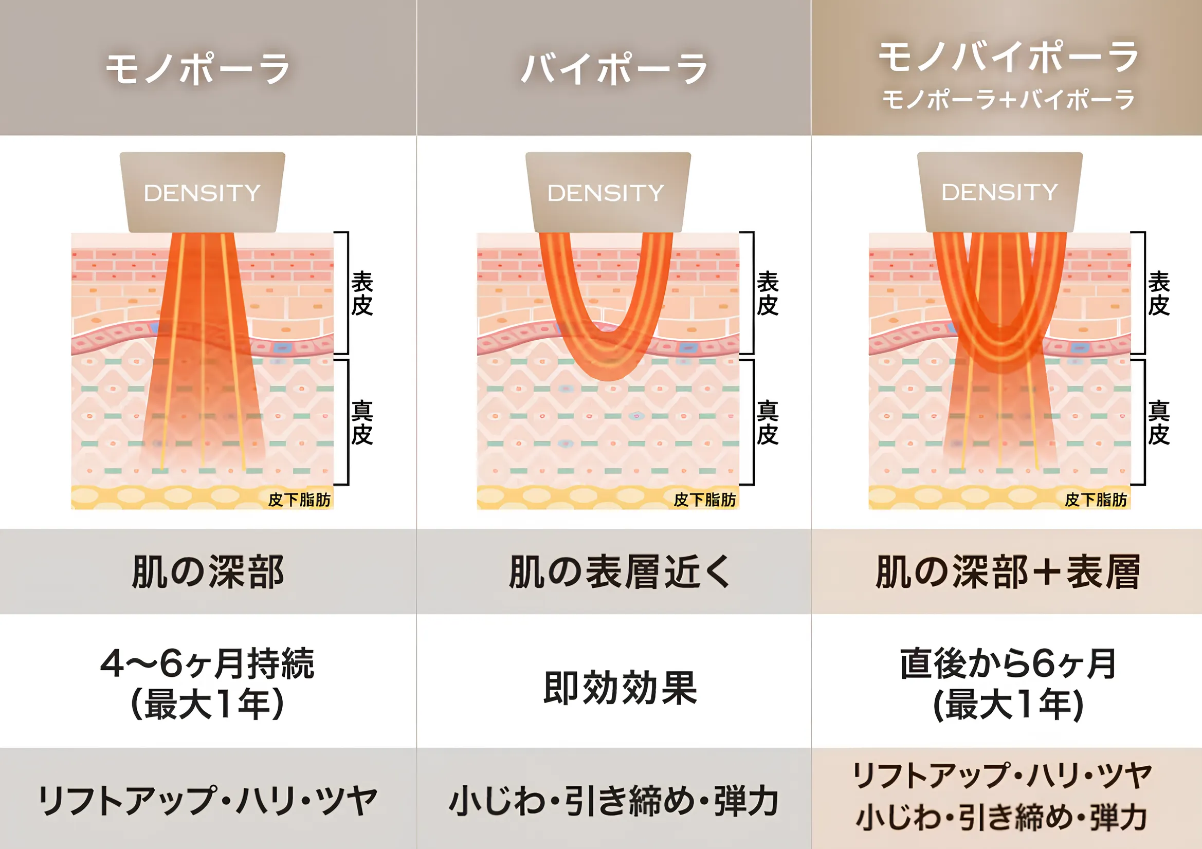 湘南美容クリニックのデンシティ施術内容