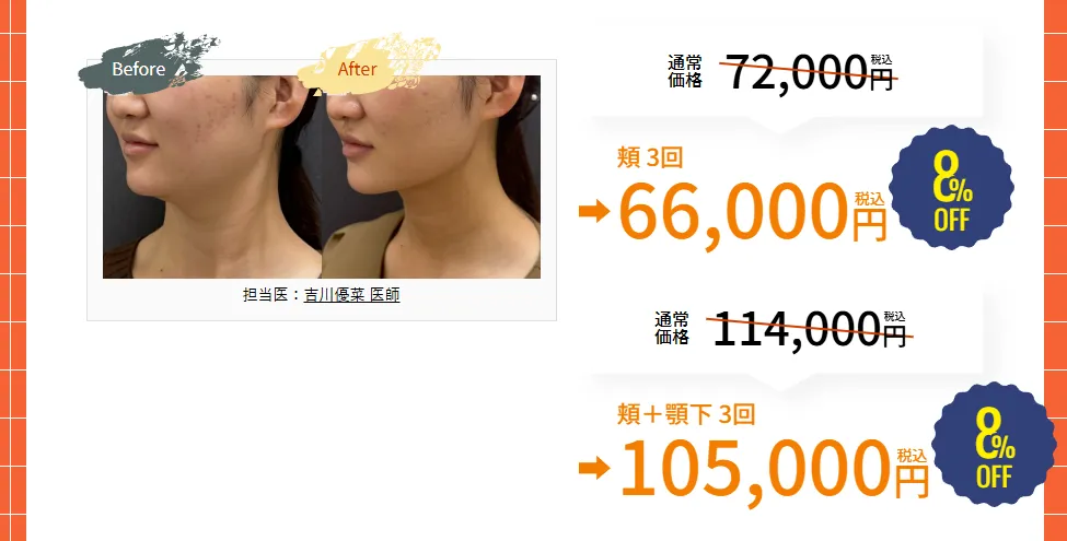 神戸でオンダリフトが安いおすすめクリニック 湘南美容クリニックの秋の特別価格キャンペーン