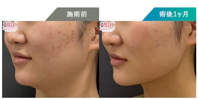 湘南美容クリニックの症例写真