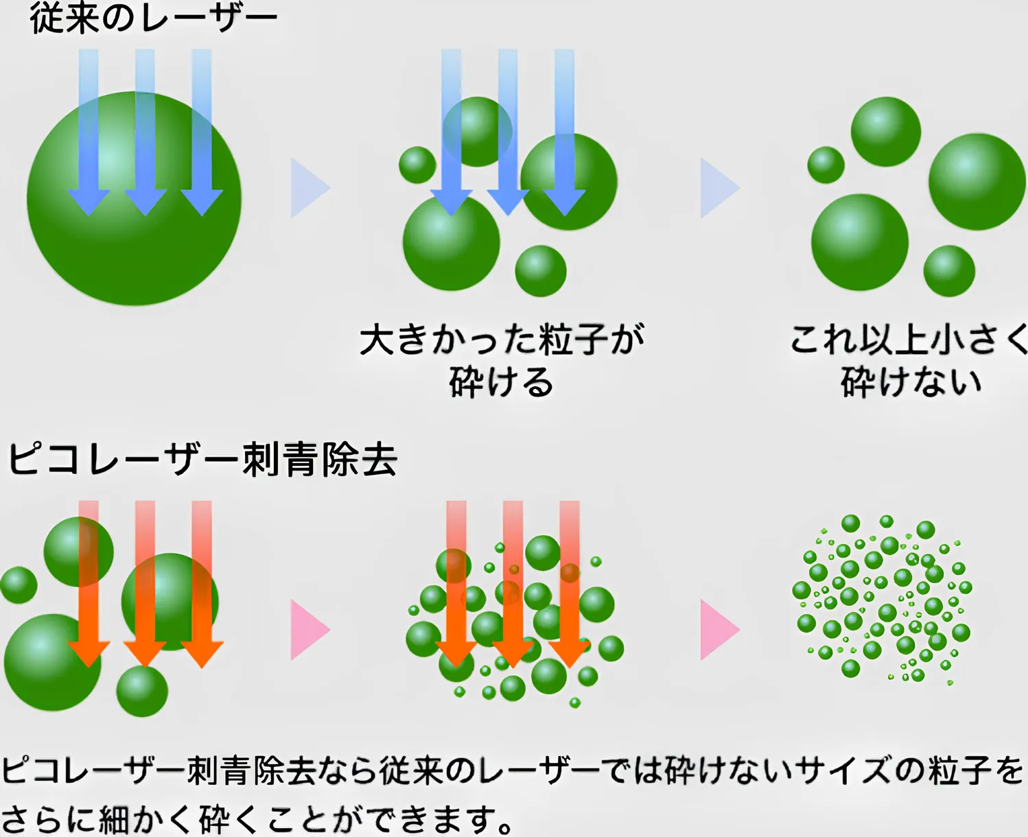 湘南美容クリニックのピコレーザー説明画像