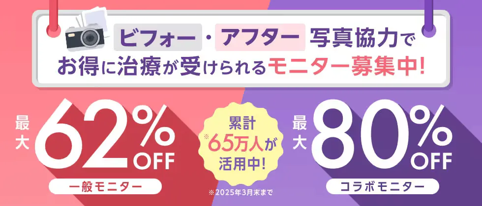 湘南美容クリニックのタトゥー除去がモニターでお得