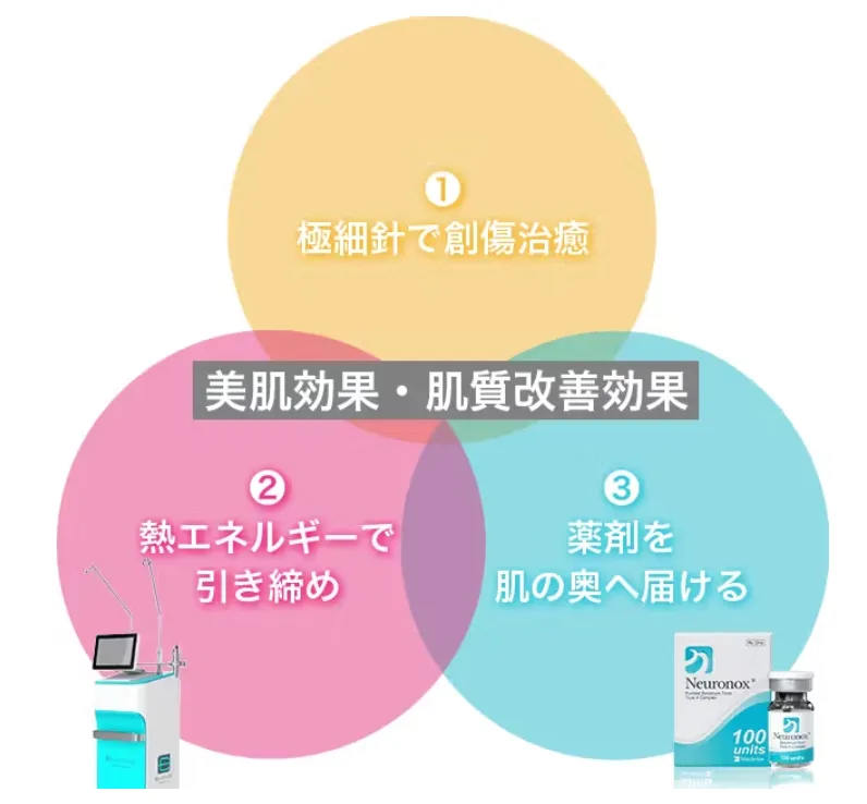 札幌でエリシスセンスが安いおすすめクリニック 品川スキンクリニックのエリシスセンスの3つの効果