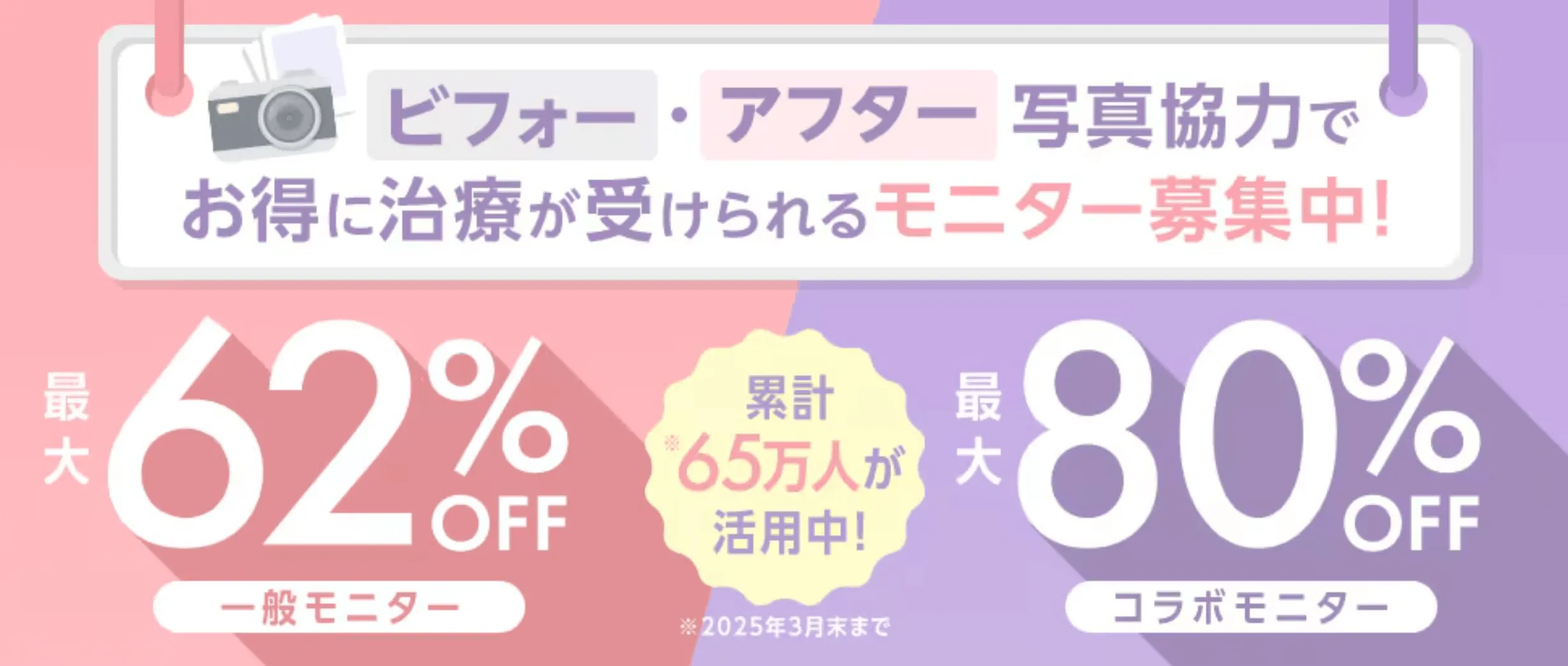 新潟でモフィウス8が安い湘南美容クリニックのモニター制度