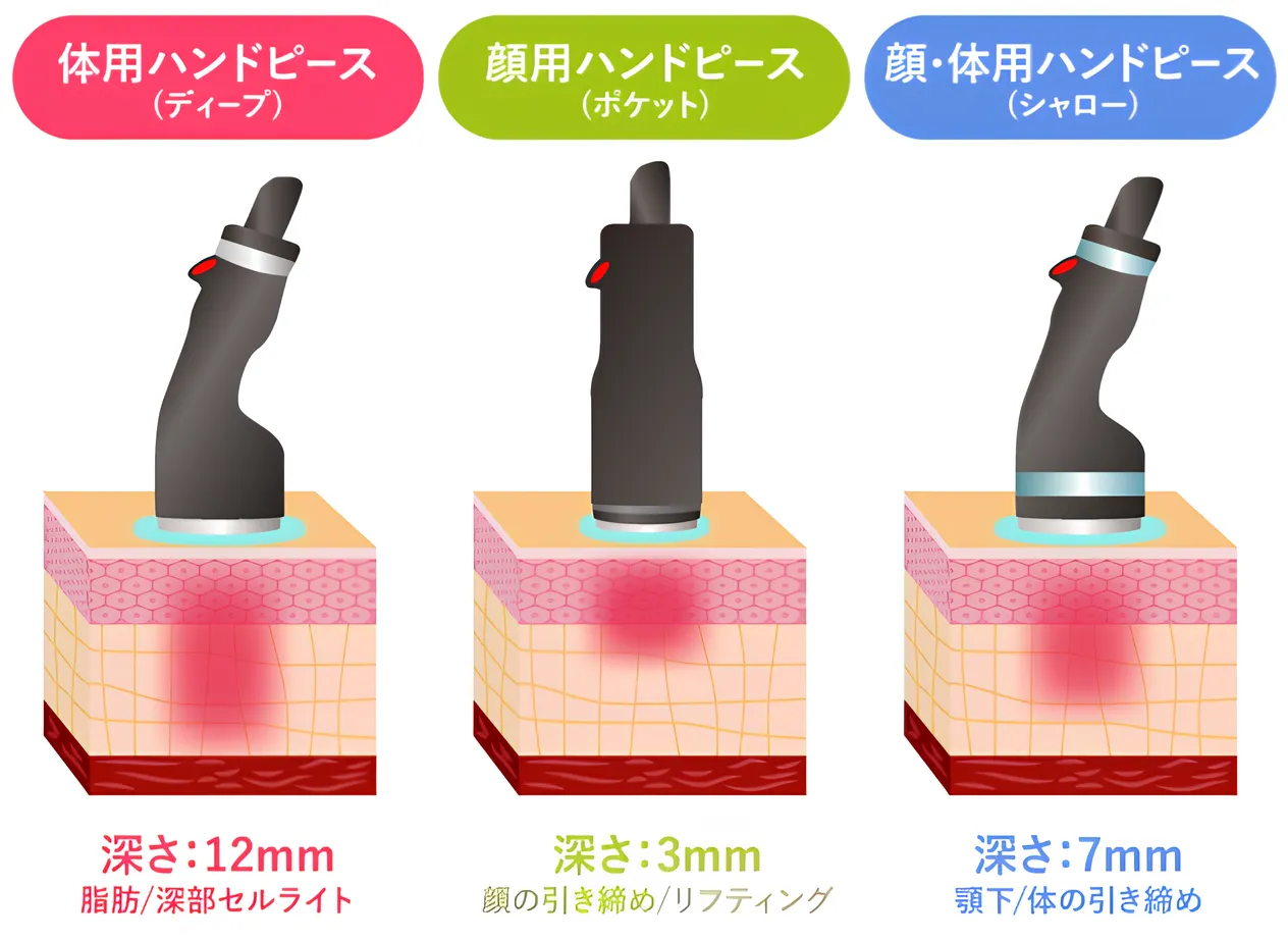 TAクリニックのオンダリフトの施術詳細