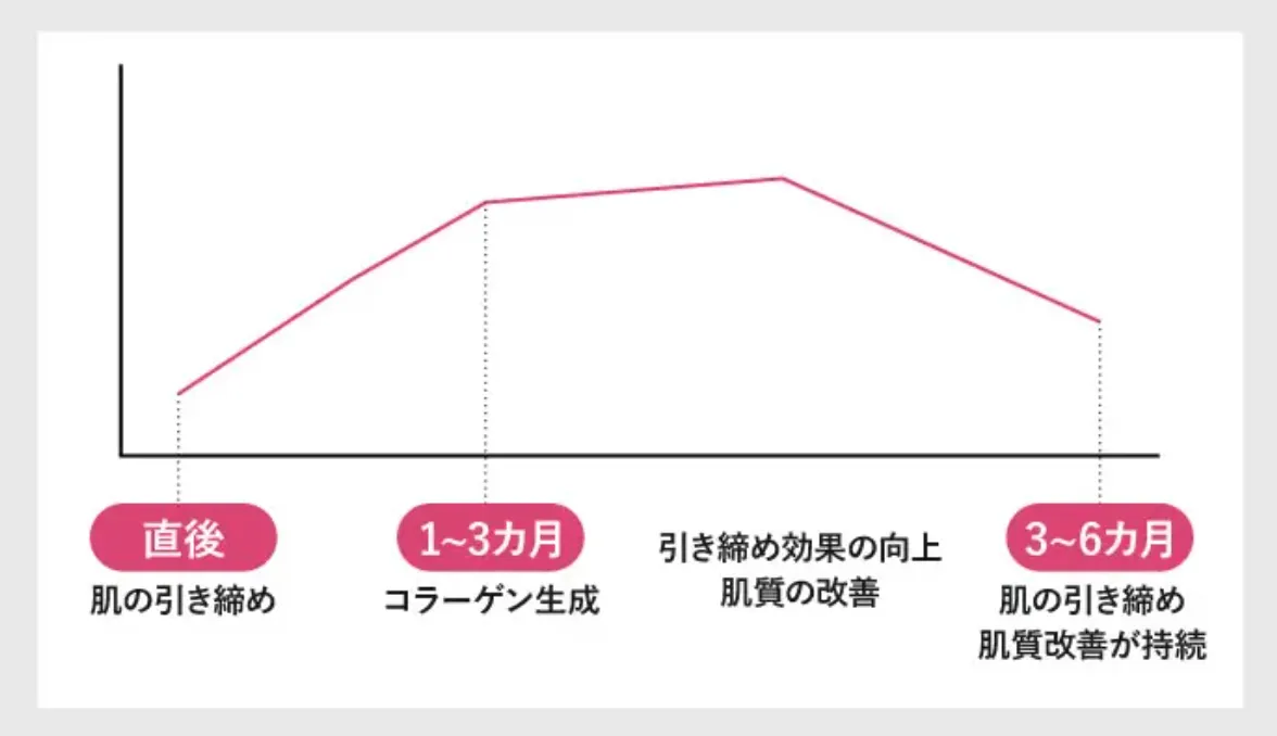 の口コミ評判が良いTAクリニックのボルニューマの施術内容