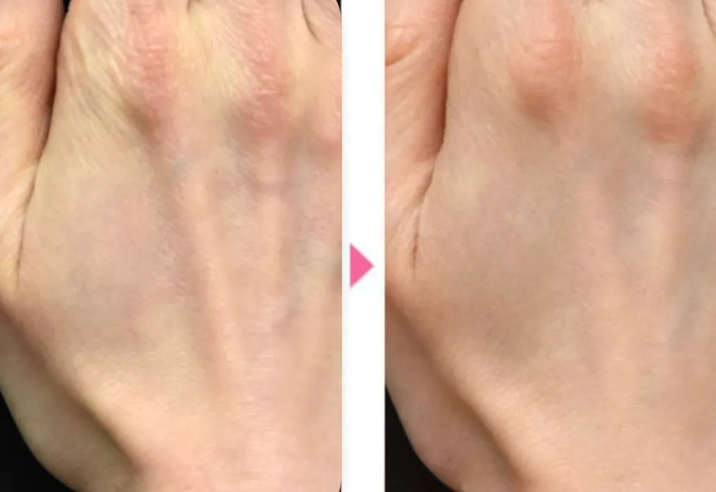 湘南美容クリニックのプロファイロの症例