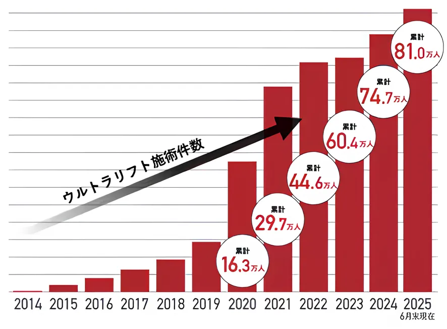 湘南美容クリニックのウルトラリフトプラスHIFUは81万人の累計実績