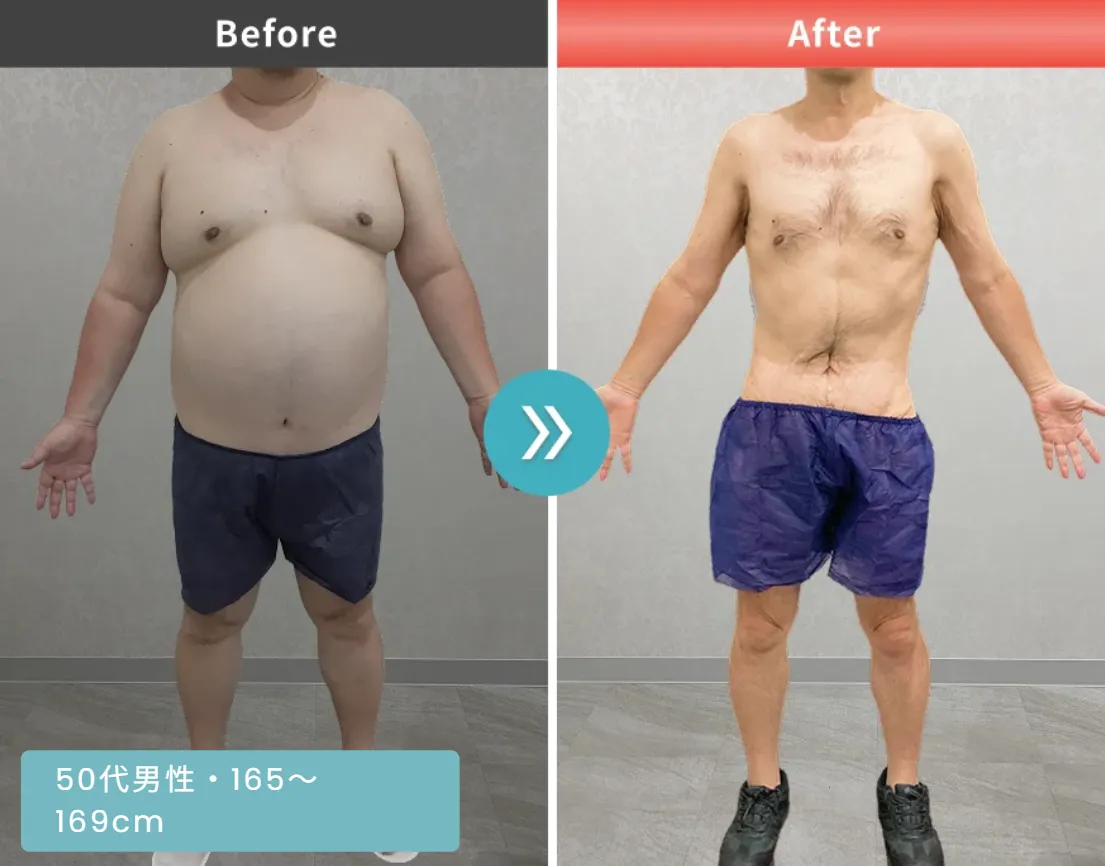 口コミで評判のURARAクリニックの無料モニター症例①