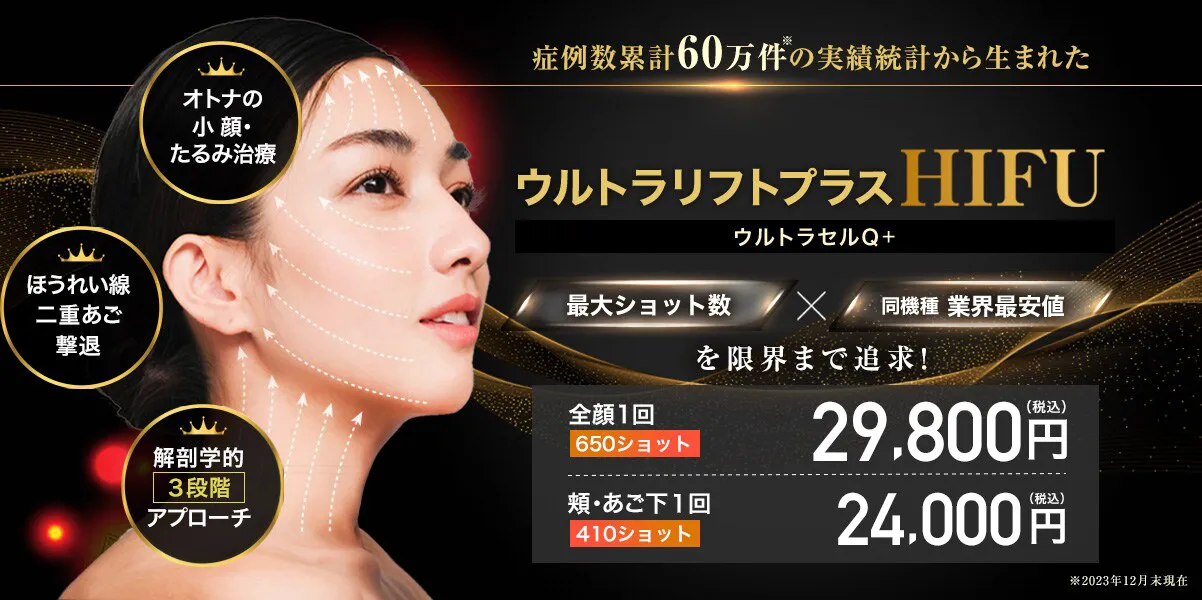 横浜で医療ハイフの安いおすすめ人気クリニック 湘南美容クリニックのウルトラリフトプラス