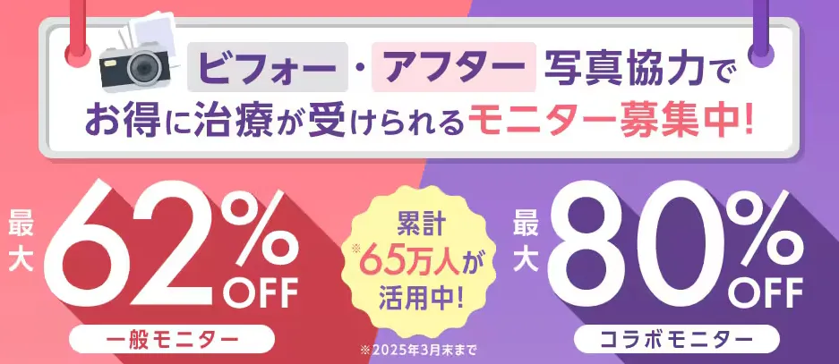 横浜でミラドライが安いおすすめのクリニック 湘南美容クリニックの仕組み