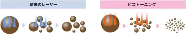 横浜でピコトーニングが安いおすすめのクリニック湘南美容クリニック　施術内容