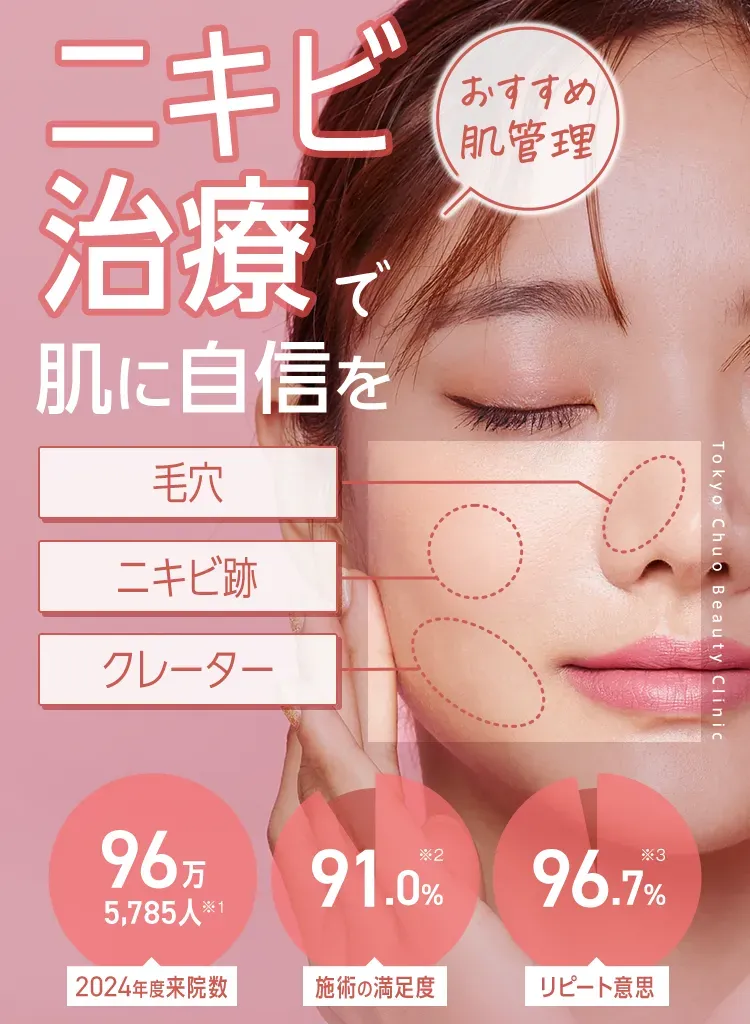 TCBのニキビ治療