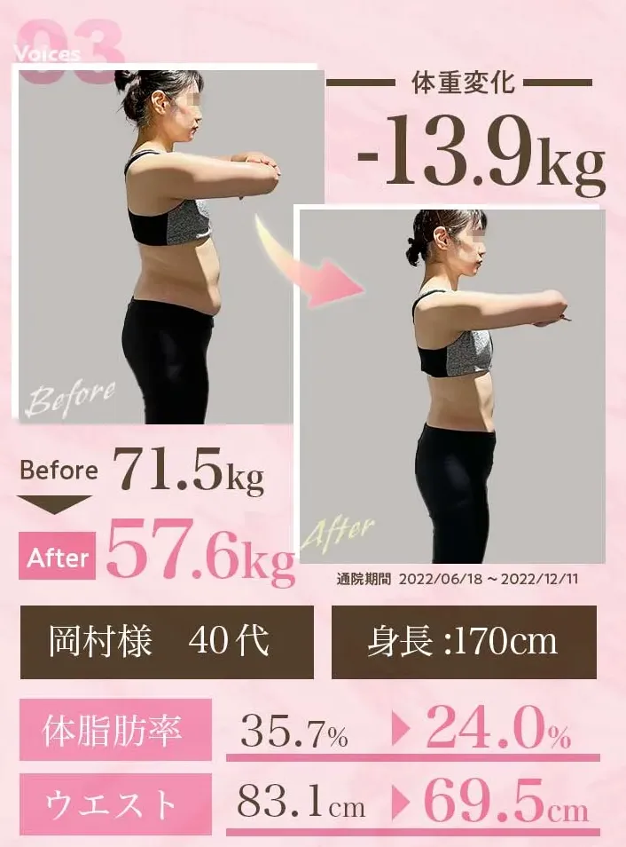 ディオクリニックの医療ダイエットの症例写真