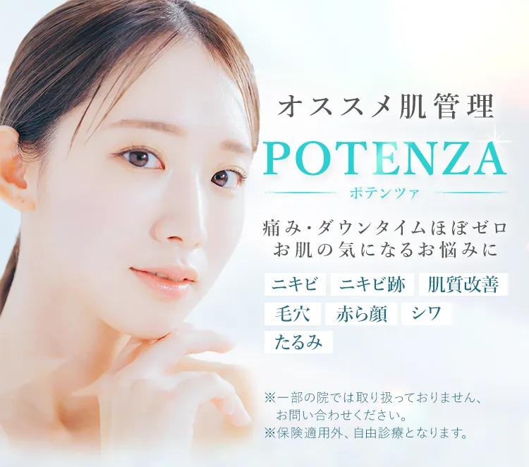 TCBのポテンツァ