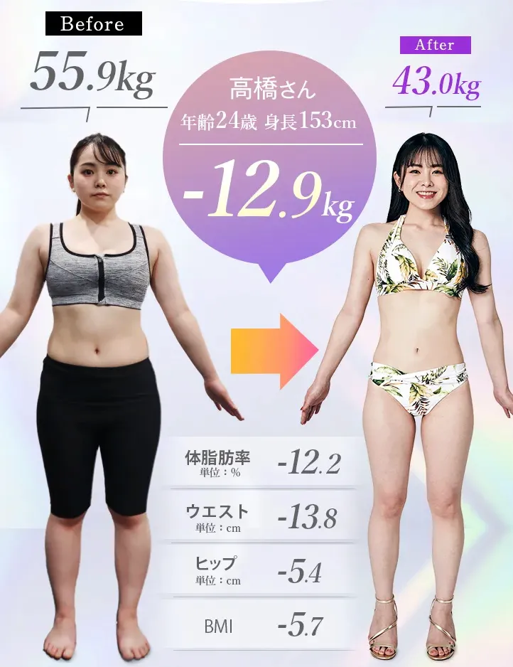 ディオクリニックの医療ダイエットの症例写真