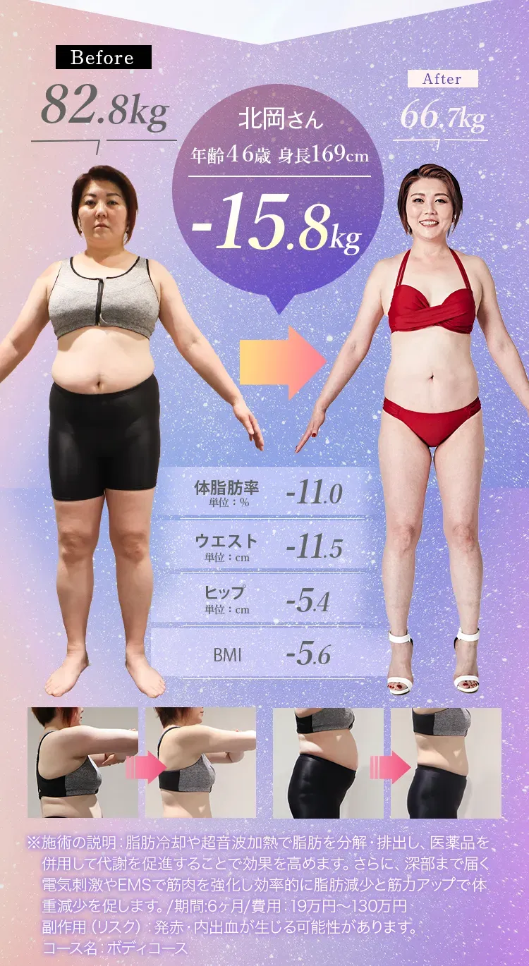 ディオクリニックの内臓脂肪の落とし方｜医療ダイエット体験者の症例写真