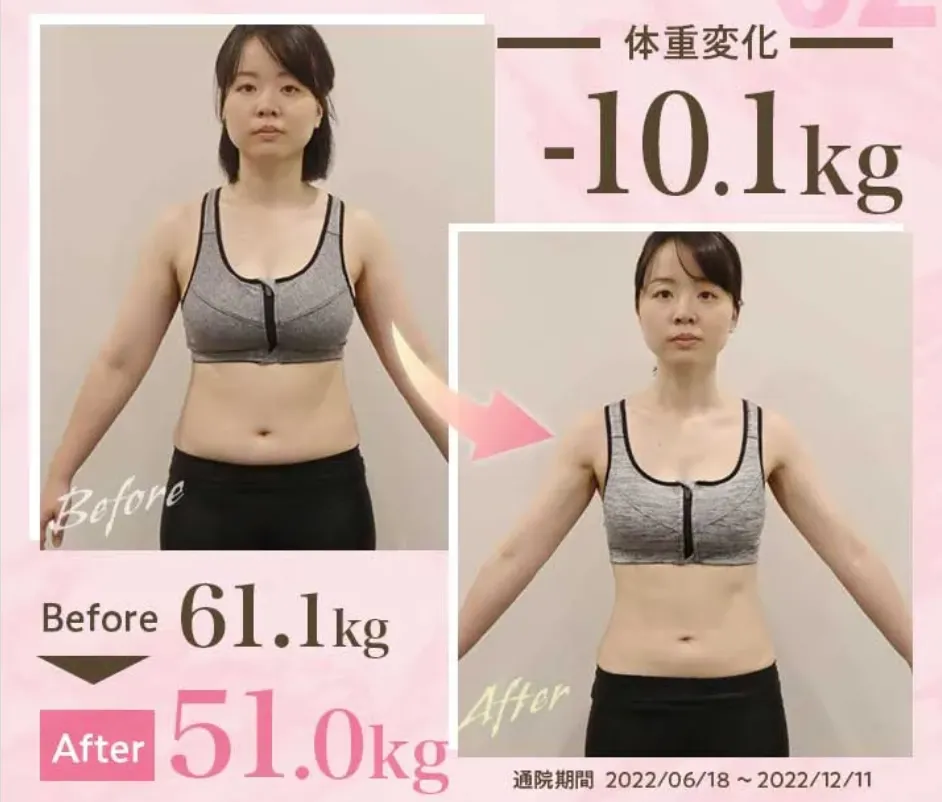 口コミ評判が良いディオクリニックの症例写真①