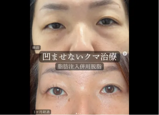 勘定正哉医師のクマ治療の症例