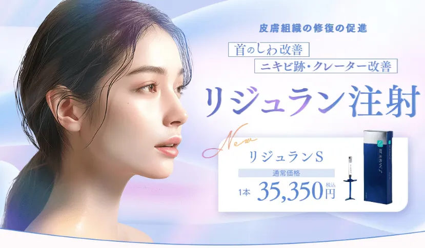 池袋でリジュラン注射が安いおすすめのクリニック　湘南美容クリニックのLP画像　リジュランS