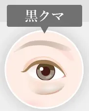 黒クマ