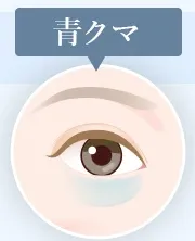 青クマ